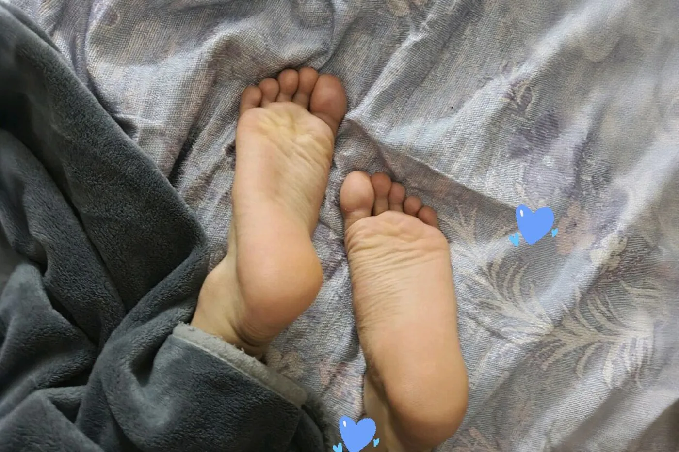 挠脚心