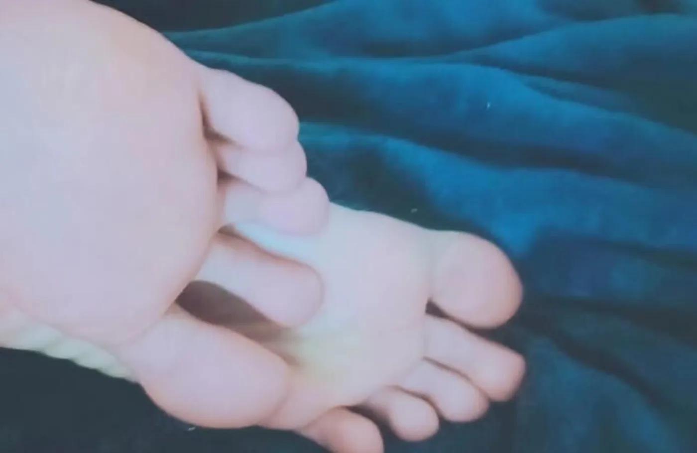 挠脚心